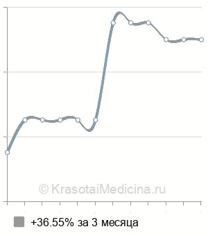 Средняя стоимость процедура на Визотроник в Воронеже
