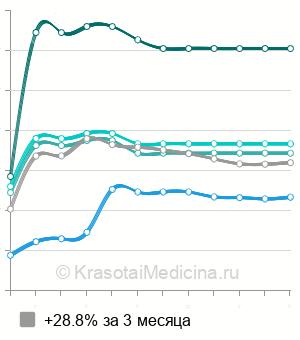 Средняя стоимость МРТ головного мозга в Воронеже